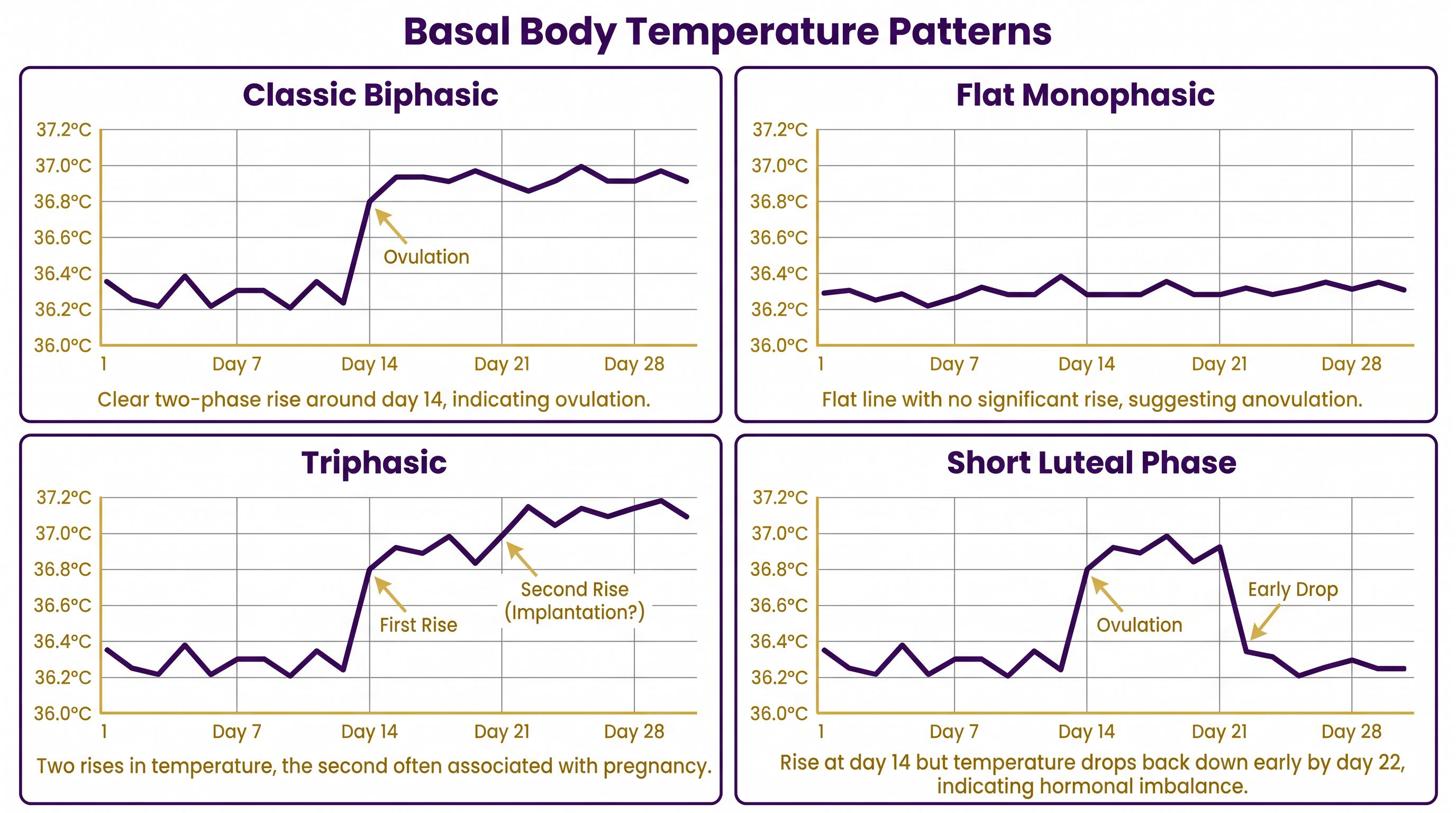 Four BBT chart patterns: classic biphasic, flat monophasic, triphasic, and short luteal phase
