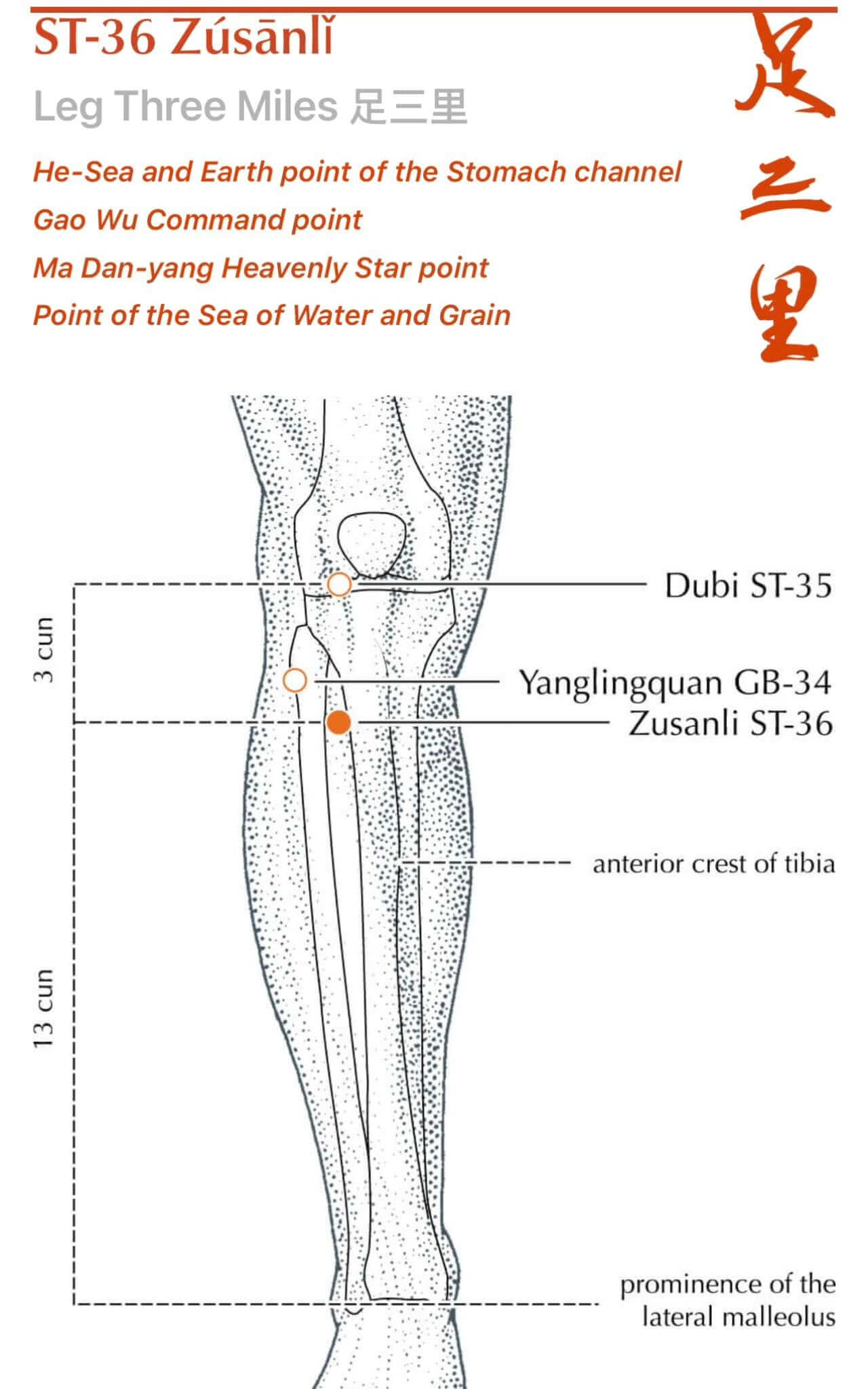 Acupuncture needling at ST36 Zusanli on the lower leg, a key point used for immune regulation and gut support in histamine intolerance treatment at Deanna Thomas clinic in Middlesbrough