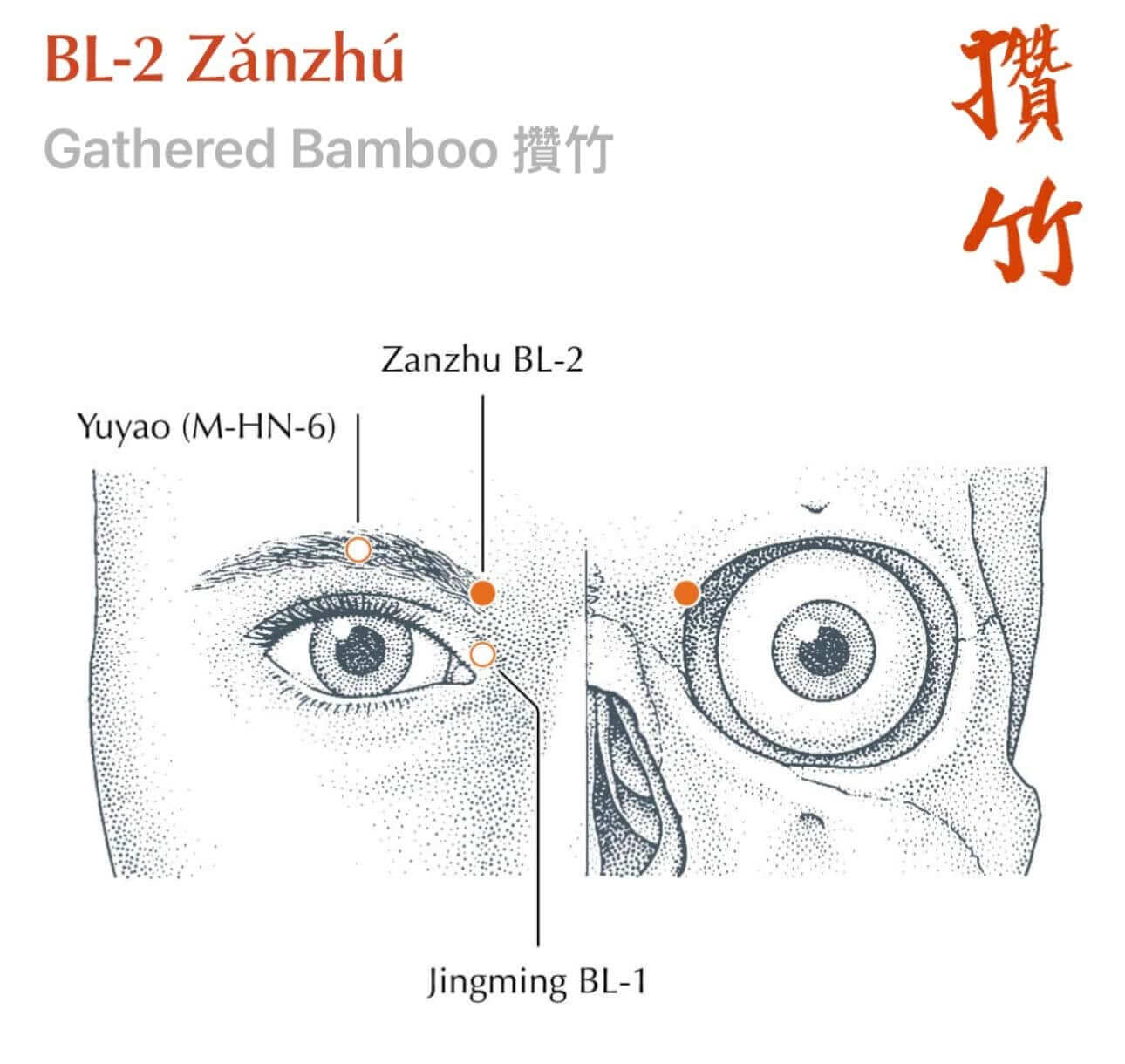 BL 2 Zanzhu acupuncture point at the inner edge of the eyebrows used to relieve sinus pressure and itchy eyes in hay fever treatment Middlesbrough