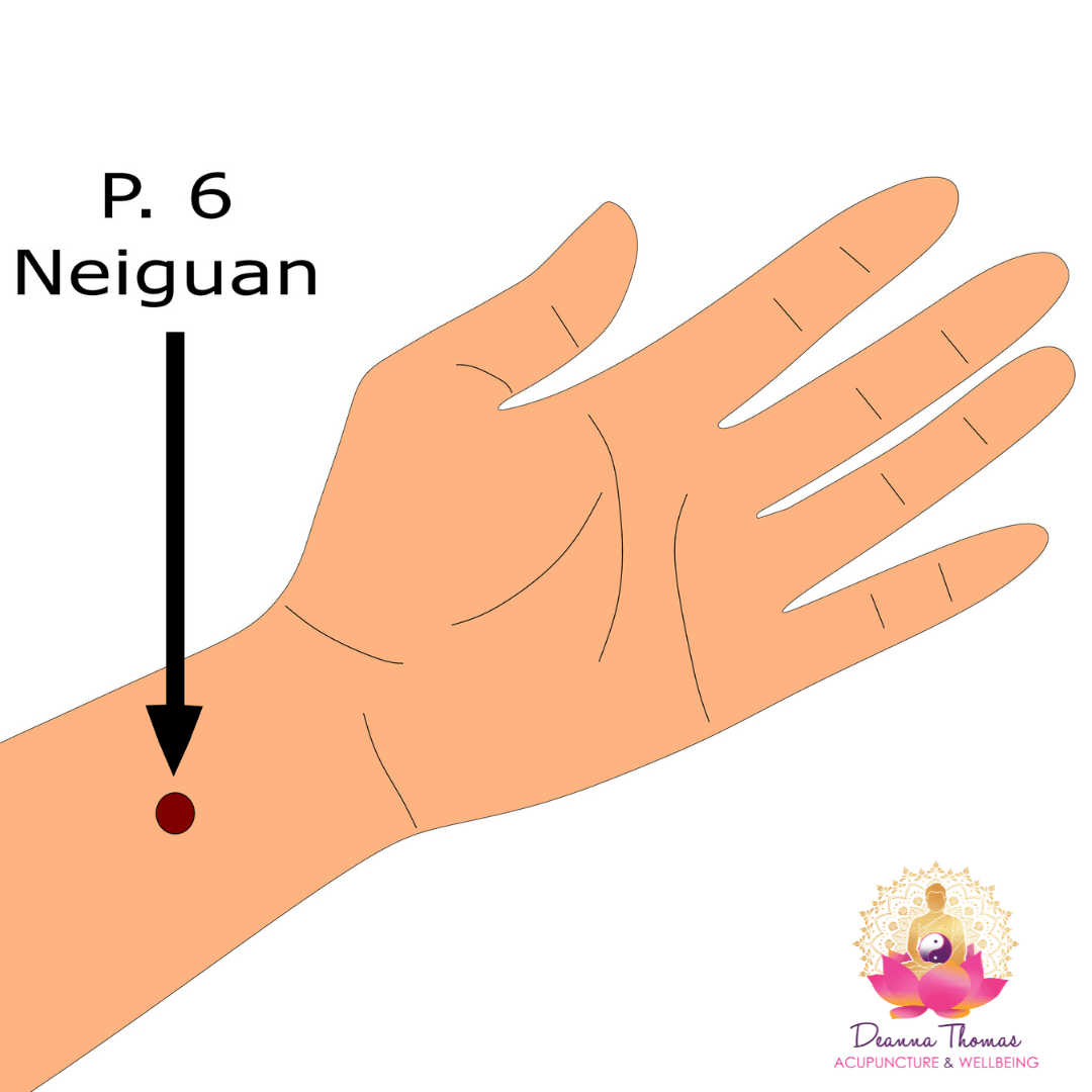 Clinical research supporting acupuncture for reducing pregnancy nausea in Middlesbrough.