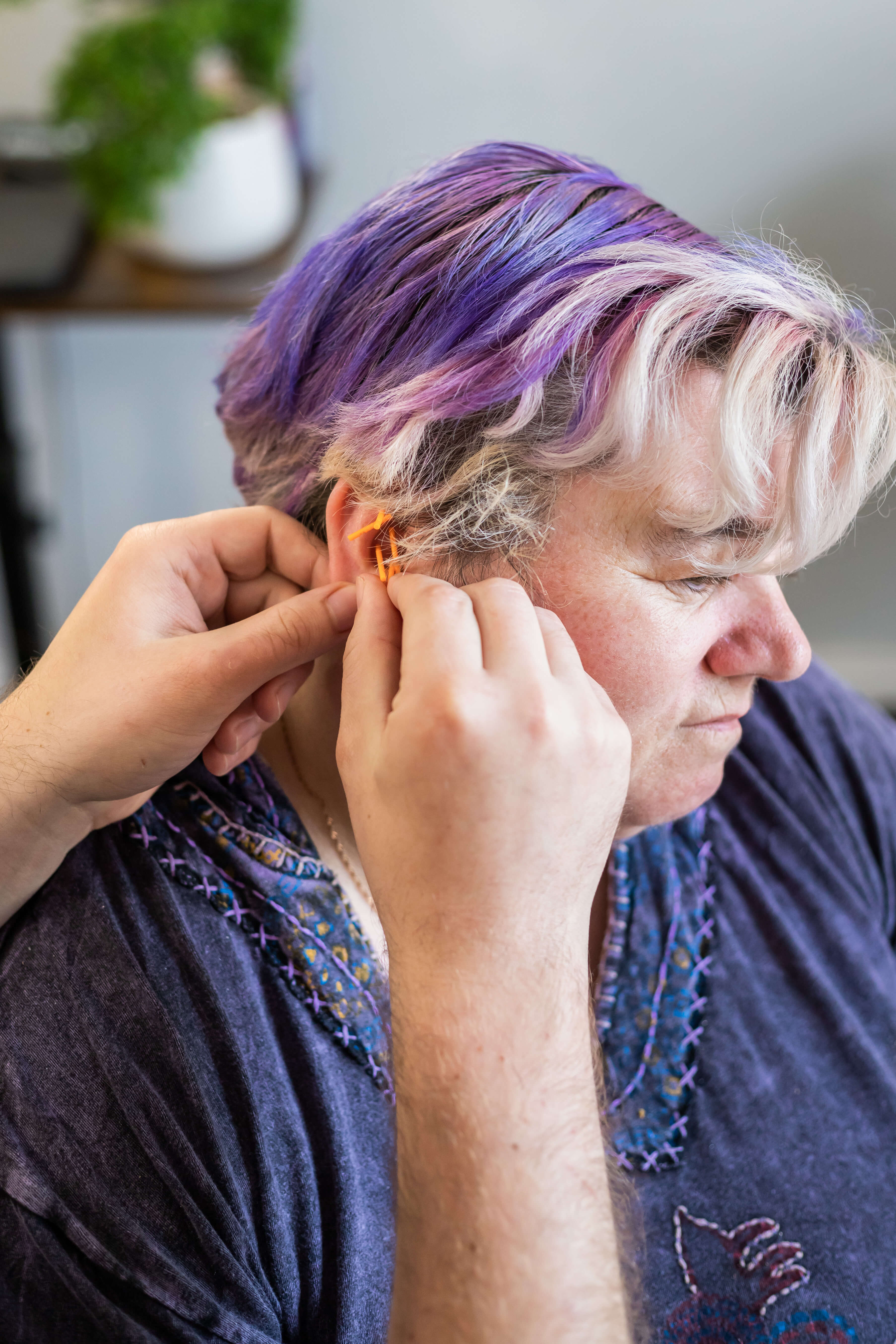 "Acupuncture treatment for weight loss at Deanna Thomas Acupuncture & Wellbeing in Middlesbrough, helping manage BMI, metabolism, and stress for sustainable weight loss."