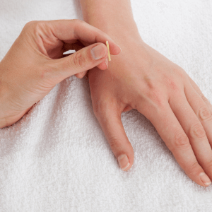 “Gentle acupuncture treatment supporting nervous system regulation and energy rebalance during a New Year Reset session.”