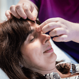 Acupuncture treatment at Deanna Thomas - Acupuncture & Wellbeing, Middlesbrough