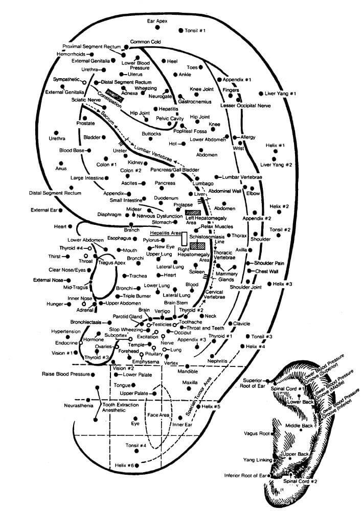 Auricular acupuncture ear map showing treatment points at Deanna Thomas clinic Middlesbrough