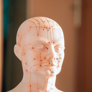 Acupuncture meridian model head showing energy pathways and acupuncture points used in Traditional Chinese Medicine allergy treatment