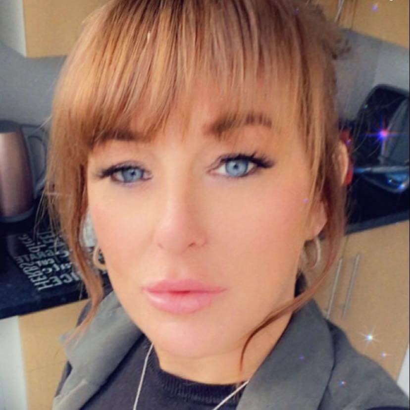 "Client testimonial for lip fillers at Helena Aesthetics in Middlesbrough - Kerry shares her positive experience with natural-looking lip enhancement and exceptional aftercare."