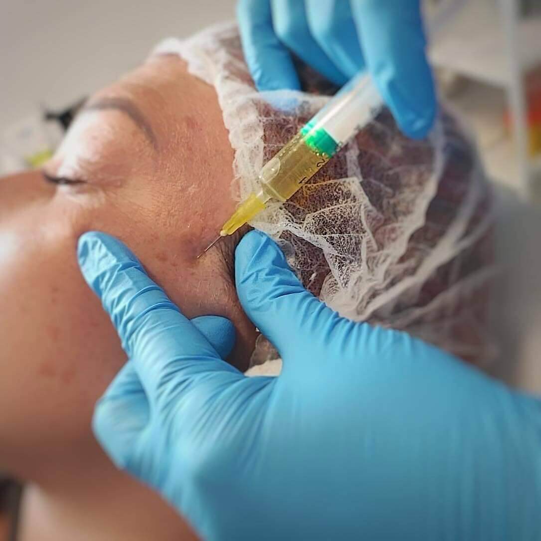 "Client testimonial for Helena Aesthetics in Middlesbrough - Sharlene shares her positive experience with chin and Botox treatments.