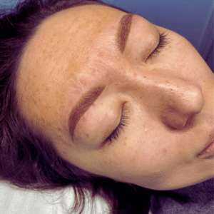 "Eyebrow Tattoo Middlesbrough – Semi-Permanent Brows Before and After" – A happy client shares her experience with semi-permanent eyebrow tattooing at Helena Aesthetics in Middlesbrough, achieving natural, defined brows without daily makeup.