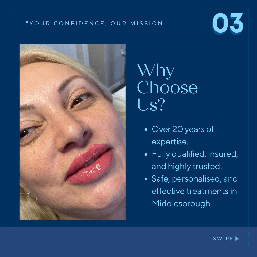 "Happy client after treatment at Helena Aesthetics Clinic in Middlesbrough, known for safe, insured, and personalized aesthetic procedures."