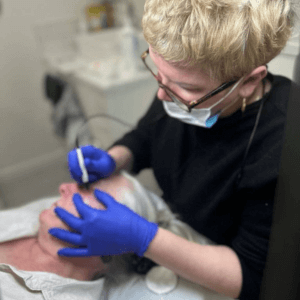 "Experienced practitioner at Helena Aesthetics Clinic performing professional skin tag removal in Middlesbrough with minimal discomfort."